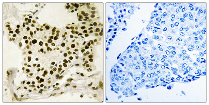 UBF (Phospho-Ser484) Antibody 