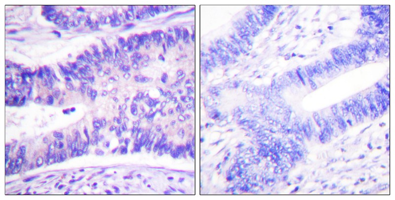 WAVE1 (Phospho-Tyr125) Antibody 