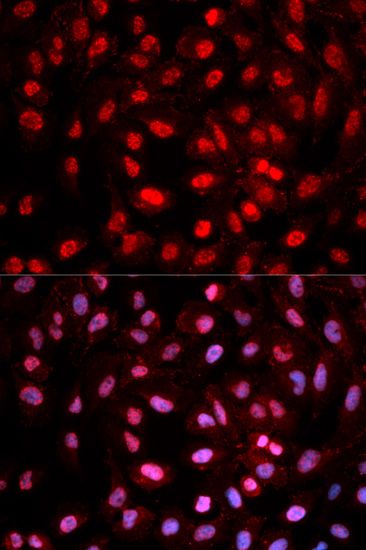 Dnmt1(Phospho-Tyr399) antibody