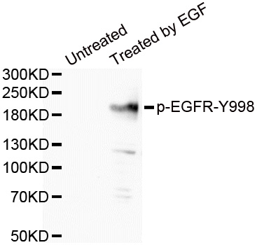 EGFR(Phospho-Tyr998) antibody