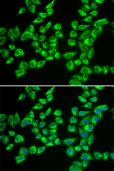 HADHB antibody