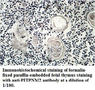 PITPNM2 Antibody