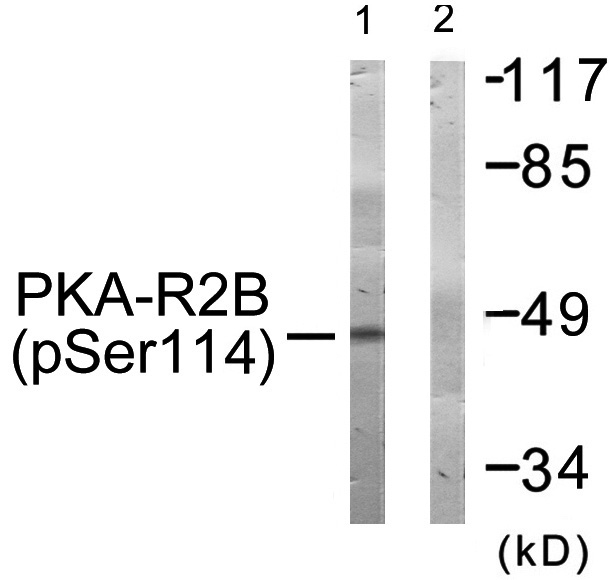 PKA-R2β (Phospho-Ser114) Antibody