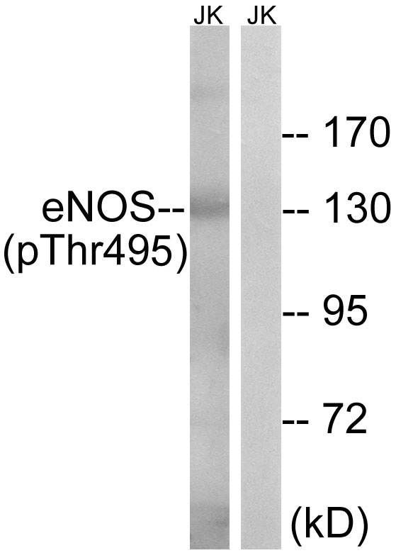 eNOS (Phospho-Thr495) Antibody