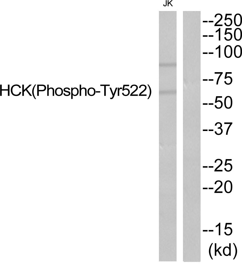 HCK (Phospho-Tyr522) Antibody