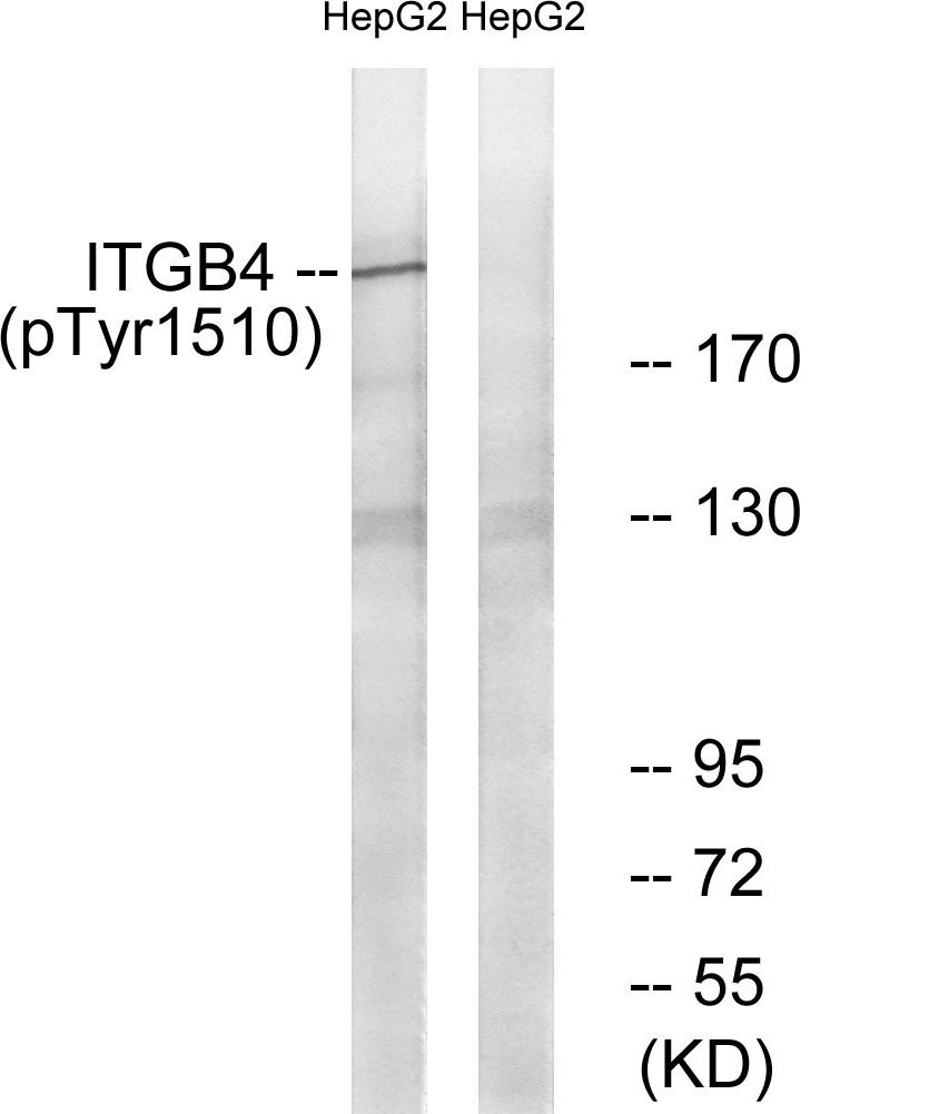 ITGB4 (Phospho-Tyr1510) Antibody