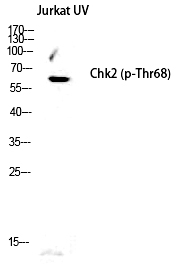 Chk2 (Phospho-Thr68) Polyclonal Antibody