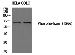 Ezrin (Phospho-Thr566) Polyclonal Antibody