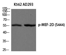 MEF-2D (Phospho-Ser444) Polyclonal Antibody