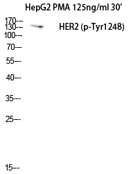 Neu (Phospho-Tyr1248) Polyclonal Antibody