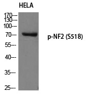 NF2 (Phospho-Ser518) Polyclonal Antibody