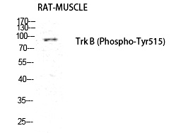 Trk B (Phospho-Tyr516) Polyclonal Antibody