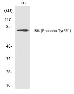 Btk (Phospho-Tyr551) Polyclonal Antibody