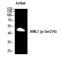 RUNX1 (Phospho-Ser249) Polyclonal Antibody