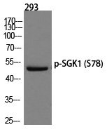 SGK1 (Phospho-Ser78) Polyclonal Antibody