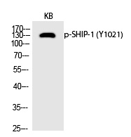 SHIP-1 (Phospho-Tyr1021) Polyclonal Antibody