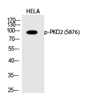 PKD2 (Phospho-Ser876) Polyclonal Antibody