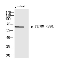 TIP60 (Phospho-Ser86) Polyclonal Antibody