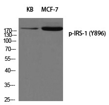 IRS-1 (Phospho-Tyr896) Polyclonal Antibody