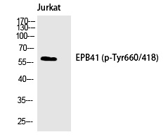 4.1R (Phospho-Tyr660) Polyclonal Antibody