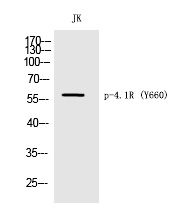 4.1R (Phospho-Tyr660) Polyclonal Antibody