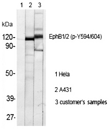 EphB1/2 (Phospho-Tyr594/604) Polyclonal Antibody