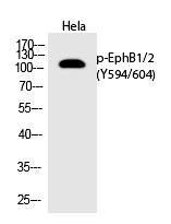 EphB1/2 (Phospho-Tyr594/604) Polyclonal Antibody