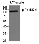 Rb (Phospho-Thr826) Polyclonal Antibody