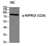 HSP90β (Phospho-Ser226) Polyclonal Antibody