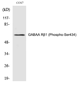 GABAA Rβ1 (Phospho-Ser434) Polyclonal Antibody