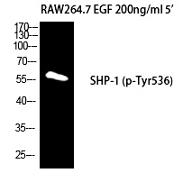 SH-PTP1 (Phospho-Tyr536) Polyclonal Antibody