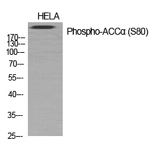 ACCα (Phospho-Ser80) Polyclonal Antibody