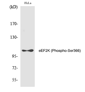 eEF2K (Phospho-Ser366) Polyclonal Antibody