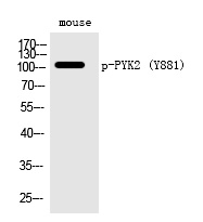 PYK2 (Phospho-Tyr881) Polyclonal Antibody