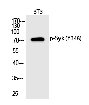 Syk (Phospho-Tyr348) Polyclonal Antibody