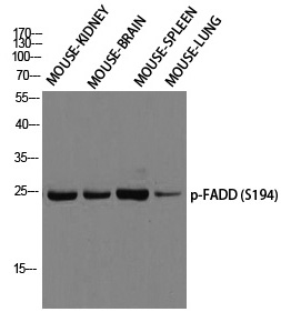 FADD (Phospho-Ser194) Polyclonal Antibody