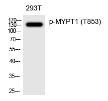 MYPT1 (Phospho-Thr853) Polyclonal Antibody