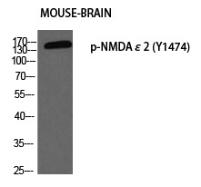 NMDAε2 (Phospho-Tyr1474) Polyclonal Antibody