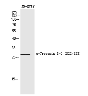 Troponin I-C (Phospho-Ser22/Ser23) Polyclonal Antibody