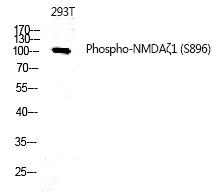 NMDAζ1 (Phospho-Ser896) Polyclonal Antibody