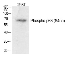 p63 (Phospho-Ser455) Polyclonal Antibody