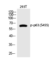 p63 (Phospho-Ser455) Polyclonal Antibody