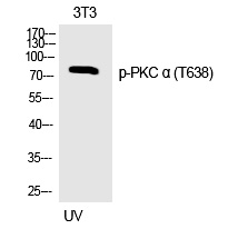 PKC α (Phospho-Thr638) Polyclonal Antibody