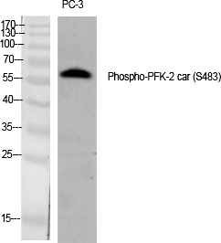 PFK-2 car (Phospho-Ser483) Polyclonal Antibody