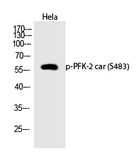 PFK-2 car (Phospho-Ser483) Polyclonal Antibody