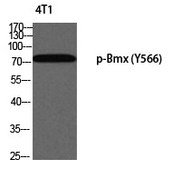 Bmx (Phospho-Tyr566) Polyclonal Antibody