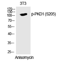 PKD1 (Phospho-Ser205) Polyclonal Antibody