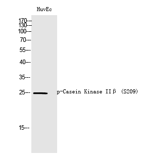 Casein Kinase IIβ (Phospho-Ser209) Polyclonal Antibody