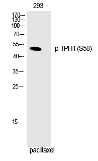 TPH1 (Phospho-Ser58) Polyclonal Antibody