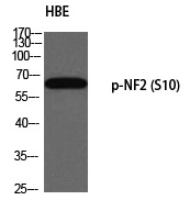 NF2 (Phospho-Ser10) Polyclonal Antibody